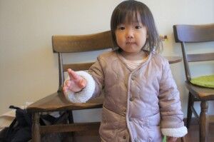 腰の痛み、股関節